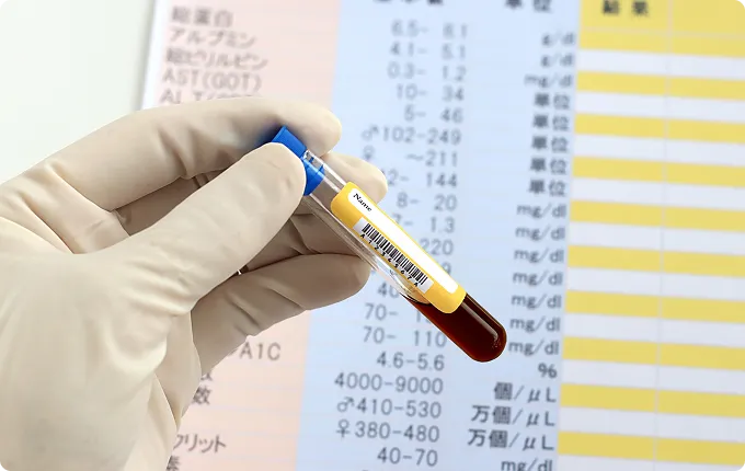 健診で「HbA1cが高い」と言われたら